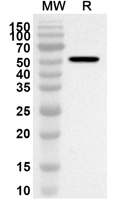 Western blot analysis was performed using anti-BCCV N/Nucleoprotein polyclonal antibody at 1ug/mL on recombinant BCCV N/Nucleoprotein (Catalog No. 31-556).