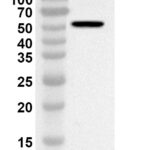 Western blot analysis was performed using anti-BCCV Gc/Glycoprotein C polyclonal antibody at 1ug/mL on recombinant BCCV Gc/Glycoprotein C (Catalog No. 31-557).