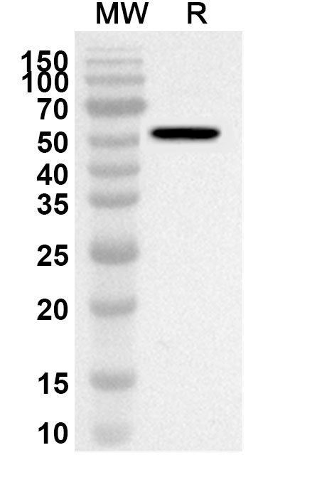 Western blot analysis was performed using anti-BCCV Gc/Glycoprotein C polyclonal antibody at 1ug/mL on recombinant BCCV Gc/Glycoprotein C (Catalog No. 31-557).
