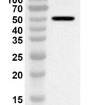 Western blot analysis was performed using anti-BCCV Gn/Glycoprotein N polyclonal antibody at 1ug/mL on recombinant BCCV Gn/Glycoprotein N (Catalog No. 31-558).
