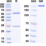 SDS-PAGE for Anti-Hantaan virus/HTNV GP Antibody (A5)