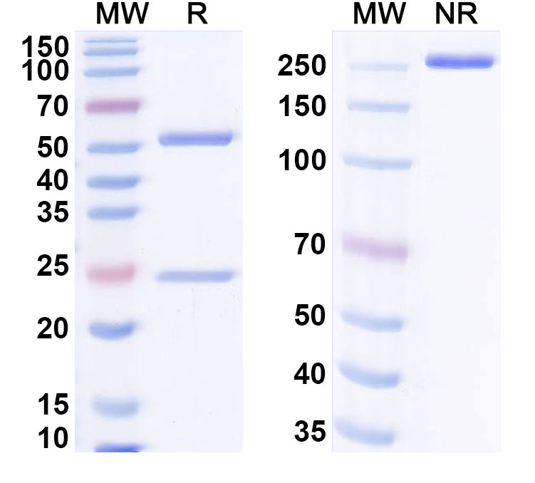 SDS-PAGE for Anti-Hantaan virus/HTNV GP Antibody (A5)