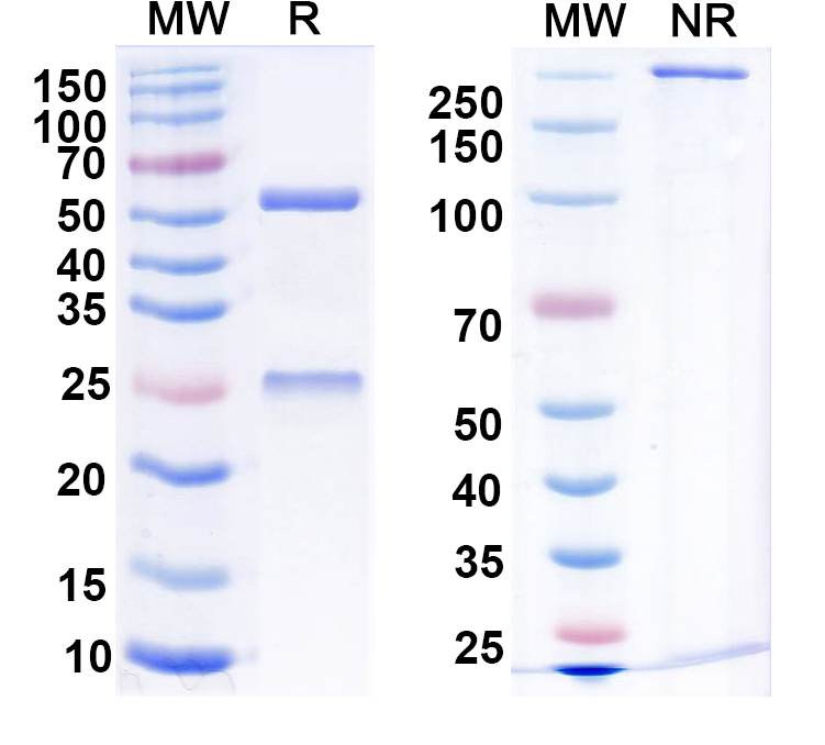 SDS-PAGE for Anti-Hantaan virus/HTNV Glycoprotein N/Gn Antibody (AH100)