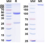 SDS-PAGE for Anti-Hantaan virus/HTNV Glycoprotein N/Gn Antibody (SAA2516)