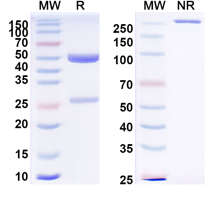 SDS-PAGE for Anti-Hantaan virus/HTNV Glycoprotein N/Gn Antibody (SAA2516)
