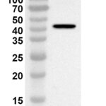 Western blot analysis was performed using anti-SNV Glycoprotein Gn polyclonal antibody at 1ug/mL on recombinant SNV Glycoprotein Gn (Catalog No. 31-574).