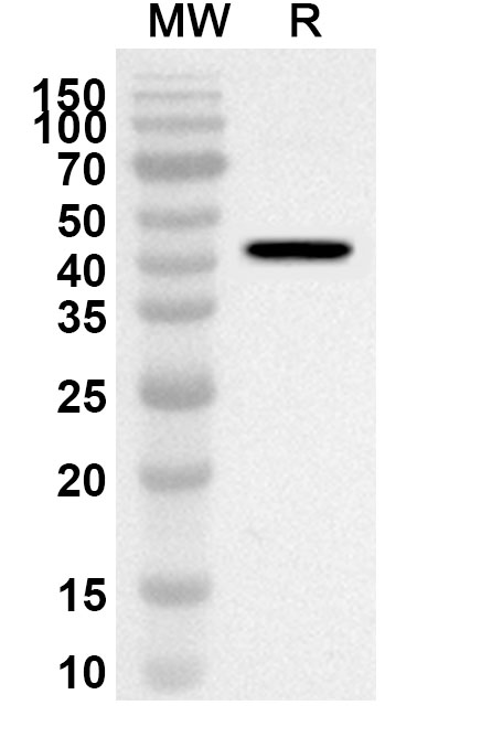 Western blot analysis was performed using anti-SNV Glycoprotein Gn polyclonal antibody at 1ug/mL on recombinant SNV Glycoprotein Gn (Catalog No. 31-574).