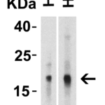 Western Blot Validation of IL-17 in Human Tissues  Loading: 10 μg of lysates per lane. Antibodies: IL-17, PM-10541, 2 μg/mL, 1h incubation at RT in 5% NFDM/TBST.Secondary: Goat anti-mouse IgG HRP conjugate at 1:5000 dilution