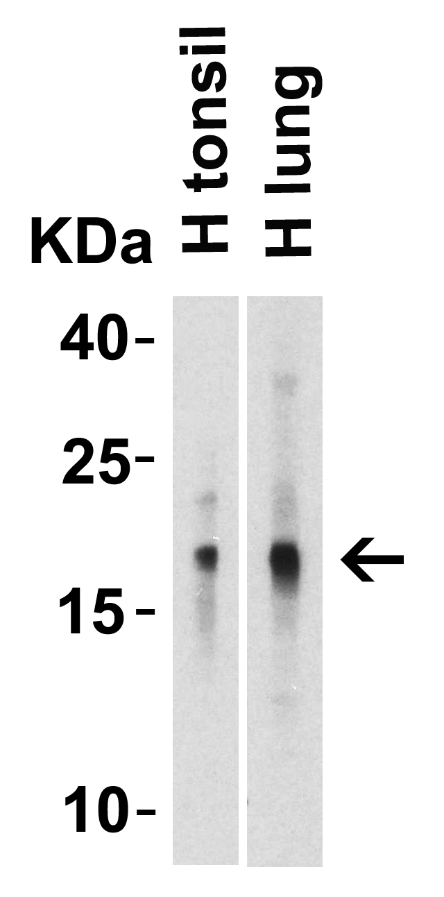 Western Blot Validation of IL-17 in Human Tissues  Loading: 10 μg of lysates per lane. Antibodies: IL-17, PM-10541, 2 μg/mL, 1h incubation at RT in 5% NFDM/TBST.Secondary: Goat anti-mouse IgG HRP conjugate at 1:5000 dilution