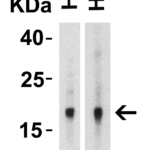 Western Blot Validation of IL-17 in Human Tissues  Loading: 10 μg of lysates per lane. Antibodies: IL-17, PM-10542, 2 μg/mL, 1h incubation at RT in 5% NFDM/TBST.Secondary: Goat anti-mouse IgG HRP conjugate at 1:5000 dilution