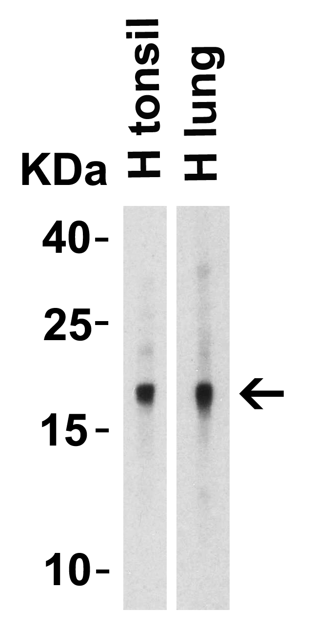 Western Blot Validation of IL-17 in Human Tissues  Loading: 10 μg of lysates per lane. Antibodies: IL-17, PM-10542, 2 μg/mL, 1h incubation at RT in 5% NFDM/TBST.Secondary: Goat anti-mouse IgG HRP conjugate at 1:5000 dilution