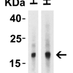 Western Blot Validation of IL-17 in Human Tissues  Loading: 10 μg of lysates per lane. Antibodies: IL-17, PM-10543, 2 μg/mL, 1h incubation at RT in 5% NFDM/TBST.Secondary: Goat anti-mouse IgG HRP conjugate at 1:5000 dilution
