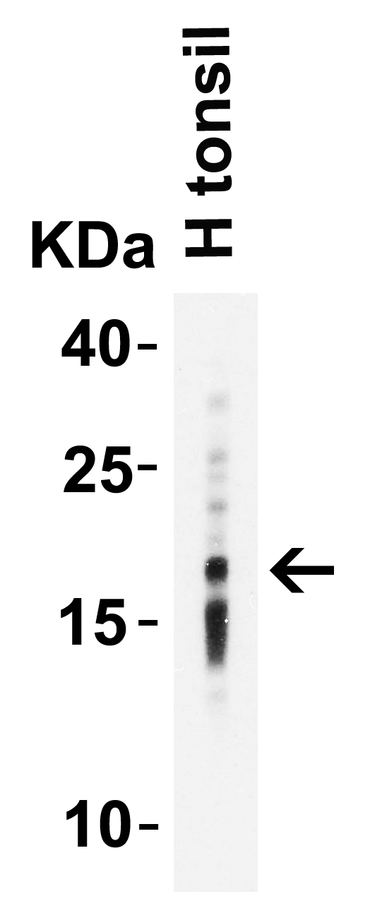 Western Blot Validation of IL-17 in Human Tonsil  Loading: 10 μg of lysates per lane. Antibodies: IL-17, PM-10543, 2 μg/mL, 1h incubation at RT in 5% NFDM/TBST.Secondary: Goat anti-mouse IgG HRP conjugate at 1:5000 dilution