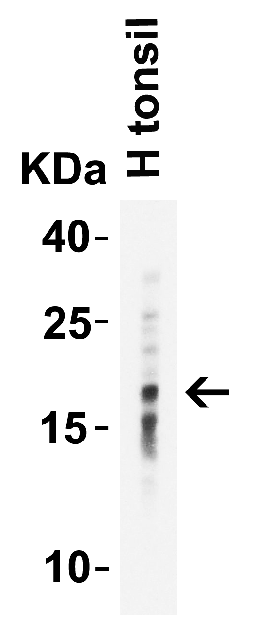Western Blot Validation of IL-17 in Human Tonsil  Loading: 10 μg of lysates per lane. Antibodies: IL-17, PM-10543, 2 μg/mL, 1h incubation at RT in 5% NFDM/TBST.Secondary: Goat anti-mouse IgG HRP conjugate at 1:5000 dilution
