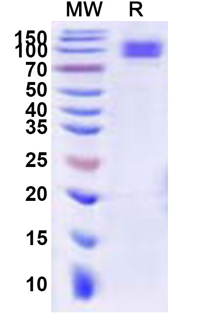 SDS-PAGE for Recombinant Bombali virus/BOMV GP1 Protein, C-His