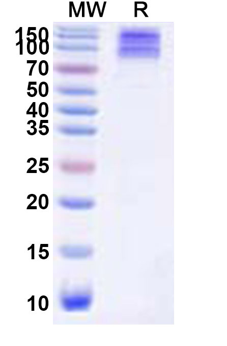 SDS-PAGE for Recombinant Bombali virus/BOMV GP1 Protein, C-Fc