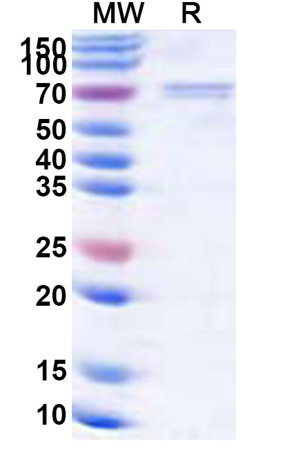 SDS-PAGE for Recombinant Bombali virus/BOMV GP1 Protein, N-His
