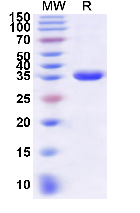 SDS-PAGE for Recombinant BDBV Envelope glycoprotein, N-His