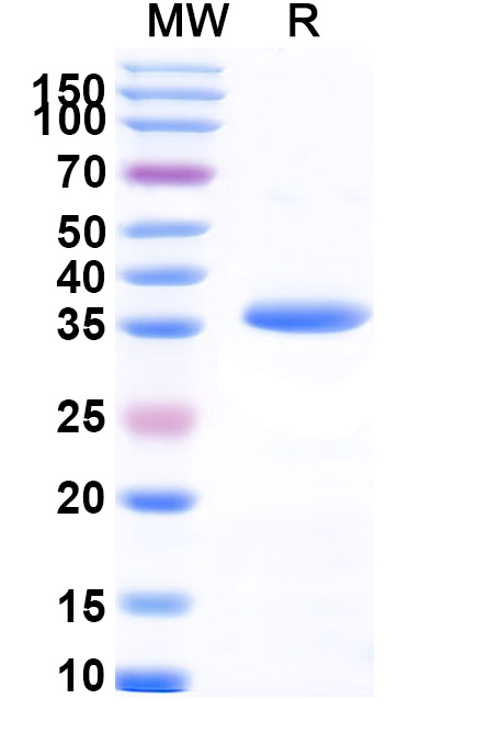 SDS-PAGE for Recombinant BDBV Matrix Protein VP40, N-His