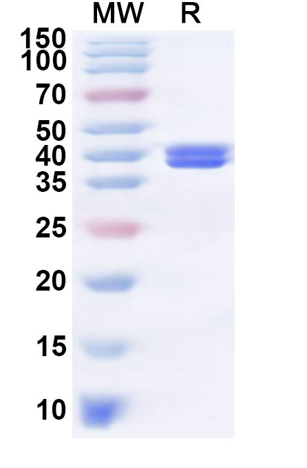 SDS-PAGE for Recombinant BDBV Nucleoprotein, N-His