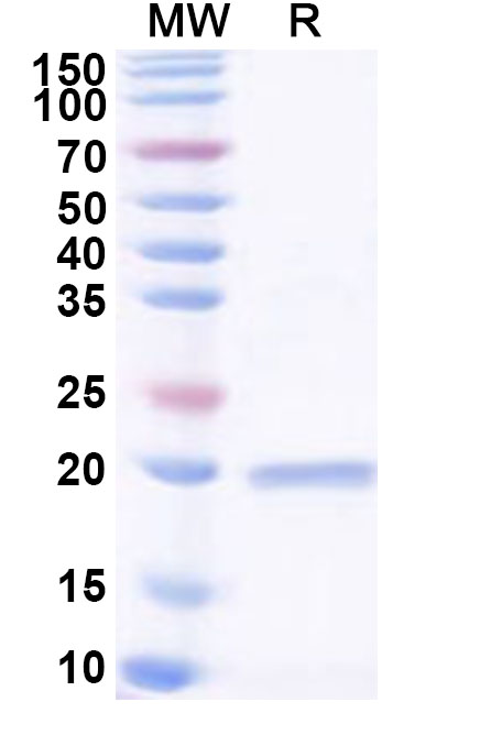 SDS-PAGE for Recombinant BDBV VP30, N-His