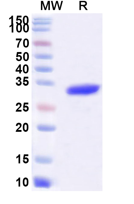 SDS-PAGE for Recombinant BDBV VP24, N-His
