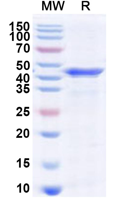 SDS-PAGE for Recombinant REBOV VP40/Matrix Protein, N-His