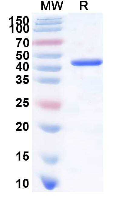 SDS-PAGE for Recombinant REBOV Nucleoprotein, N-His