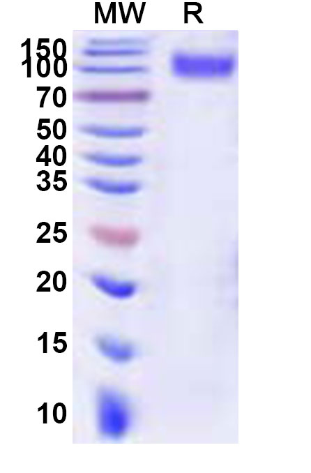SDS-PAGE for Recombinant REBOV GP1 Protein, C-His