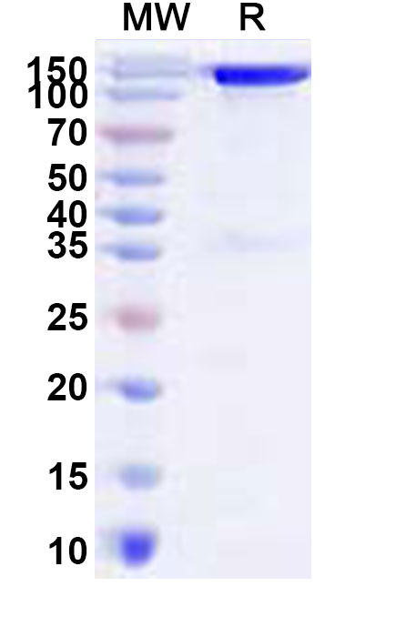SDS-PAGE for Recombinant REBOV GP1 Protein, C-Fc