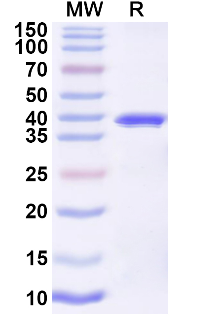 SDS-PAGE for Recombinant SEBOV Nucleoprotein, N-His