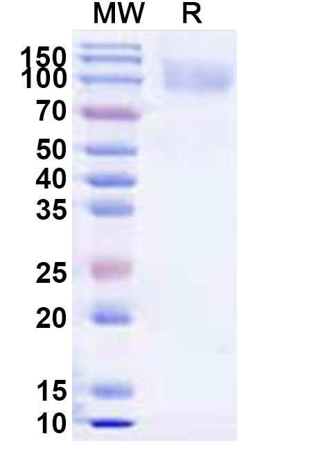 SDS-PAGE for Recombinant SEBOV GP1 Protein, C-His