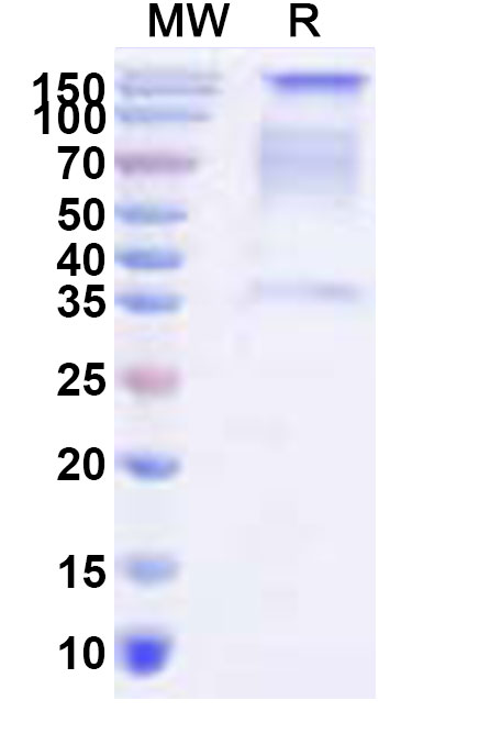 SDS-PAGE for Recombinant SEBOV GP1 Protein, C-Fc