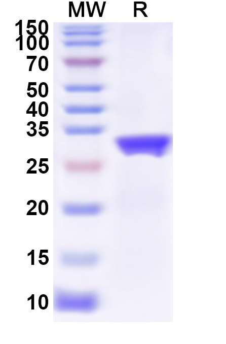 SDS-PAGE for Recombinant SEBOV VP40 Protein, N-His