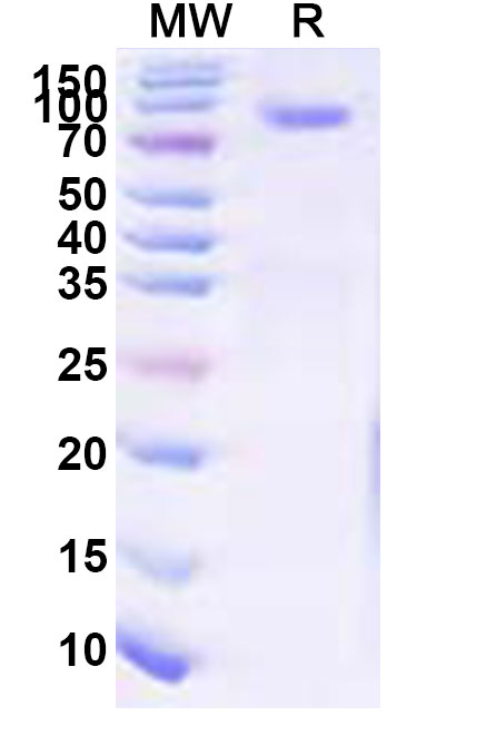 SDS-PAGE for Recombinant TAFV GP1 Protein, C-His