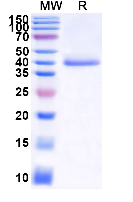 SDS-PAGE for Recombinant ZEBOV VP40 Protein, N-His-SUMO