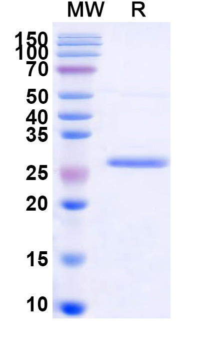 SDS-PAGE for Recombinant ZEBOV VP24 Protein, N-His