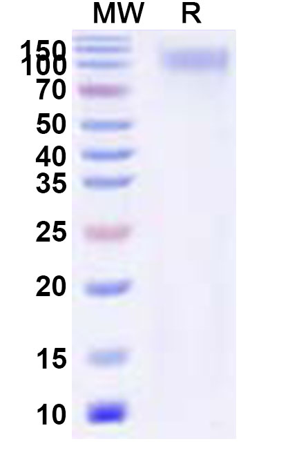 SDS-PAGE for Recombinant ZEBOV GP1 Protein, C-His