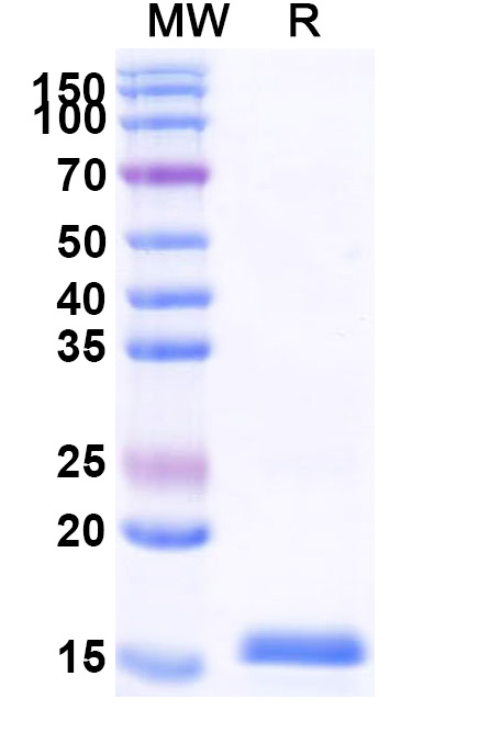 SDS-PAGE for Recombinant ZEBOV VP35 Protein, N-His