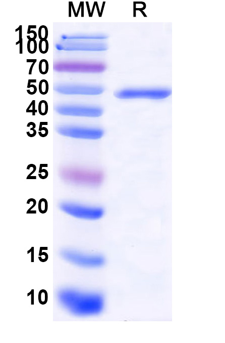 SDS-PAGE for Recombinant ZEBOV VP40 Protein, N-His-SUMO