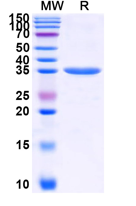 SDS-PAGE for Recombinant ZEBOV VP40 Protein, N-His