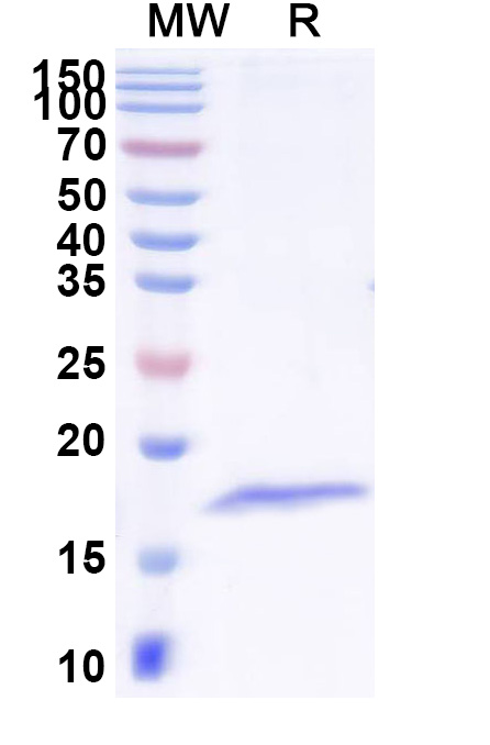 SDS-PAGE for Anti-SEBOV RNA-directed RNA polymerase L/Protein L Nanobody (SAA1489)