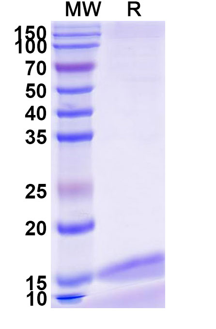SDS-PAGE for Anti-Zaire ebolavirus/ZEBOV GP/GP1,2 Nanobody (SAA1248)