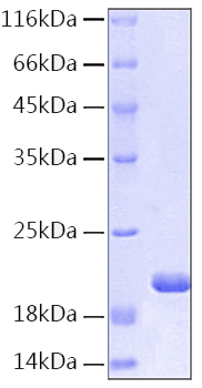 Recombinant Human IL-1RN Protein was determined by SDS-PAGE under reducing conditions with Coomassie Blue.