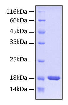 Recombinant Human PIN1 Protein was determined by SDS-PAGE under reducing conditions with Coomassie Blue.