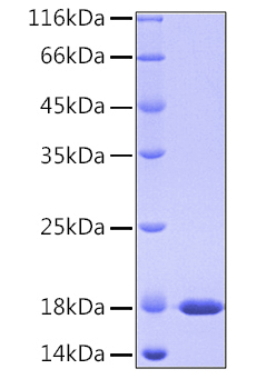 Recombinant Human PPIase A/PPIA Protein was determined by SDS-PAGE under reducing conditions with Coomassie Blue.