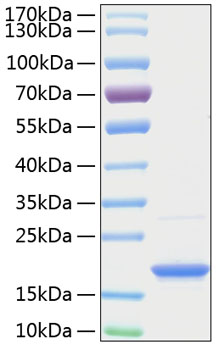 Recombinant Human TNFSF13B/BAFF/CD257 Protein was determined by SDS-PAGE under reducing conditions with Coomassie Blue.