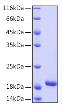 Recombinant Human IL-33 Protein was determined by SDS-PAGE under reducing conditions with Coomassie Blue.