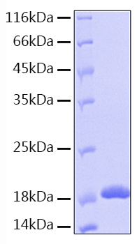 Recombinant Human IL-36 beta/IL-1F8 Protein was determined by SDS-PAGE under reducing conditions with Coomassie Blue.