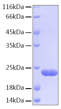 Recombinant Human BID Protein was determined by SDS-PAGE under reducing conditions with Coomassie Blue.